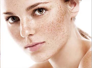 Pigmentation